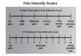 Complex Regional Pain Syndrome Diagnosis using the Budapest Criteria